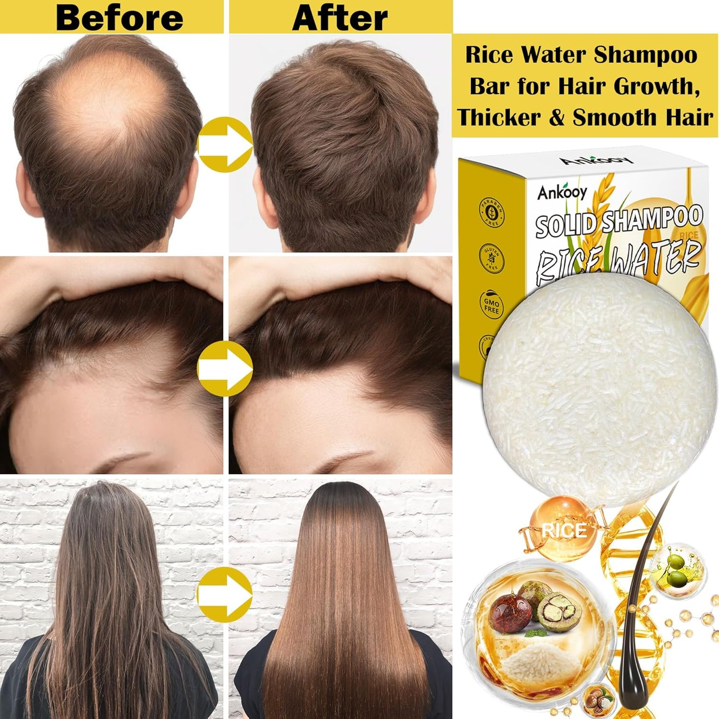 Skiennix Rice Water Shampoo Bar - Deep Cleansing Hair Growth Formula | 2 Pack, Paraben & Sulfate-Free, Vegan
