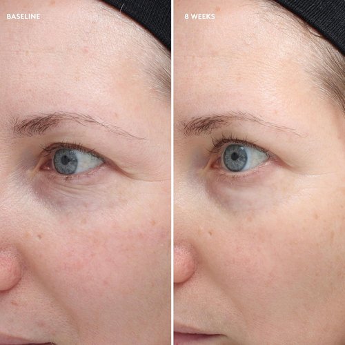 Colorescience Total Eye Firm & Repair Cream - Revitalize & Brighten Under Eyes | 0.6 Fl. Oz.