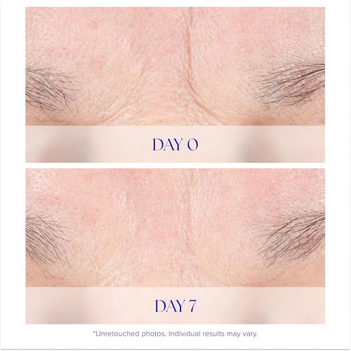 iS CLINICAL Youth Intensive Crème - Anti-Aging Firming Face Cream for Fine Lines & Wrinkles
