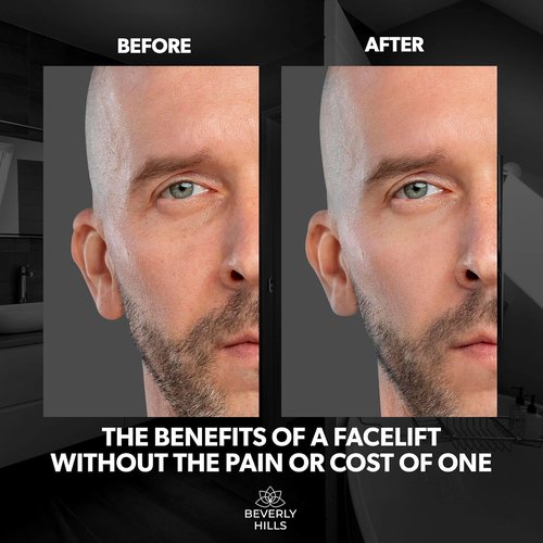 Beverly Hills Men's Instant Facelift Serum - Reduces Dark Circles & Puffy Eyes | Anti-Wrinkle Treatment
