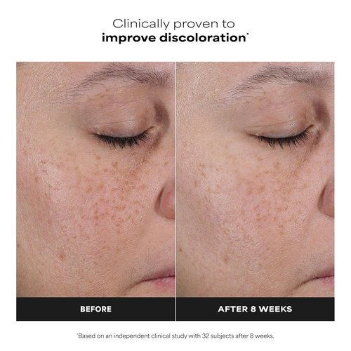 Paula’s Choice 25% Vitamin C Serum - Brightening Face Serum with Glutathione & Antioxidants | 1oz, Fragrance-Free
