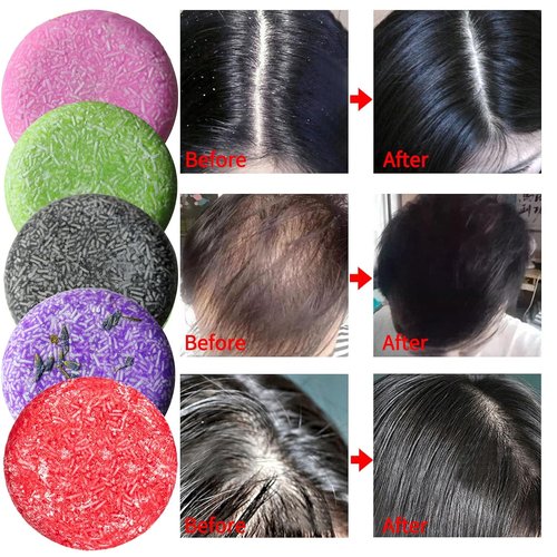 DBEAUTYM 8 Pack Shampoo Bar Gift Set - Natural Solid Soap for Dry Damaged Hair | Plant Essence Oil, Travel Size