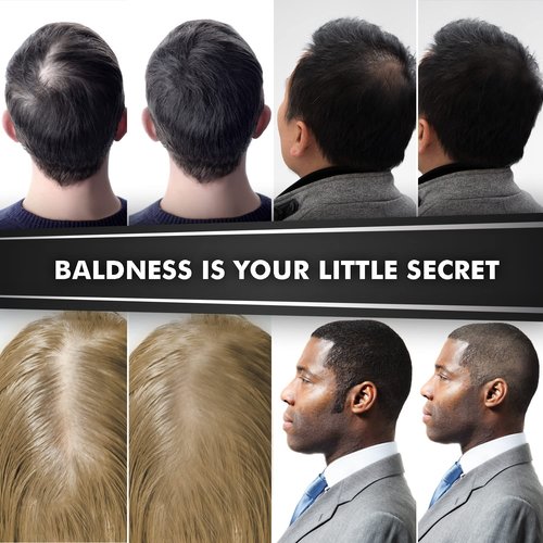 CONFIERR Hair Fibers for Men & Women (30 Grams, White), Fill In Fine or Thinning Hair, Instantly Thicker, Fuller Looking Hair