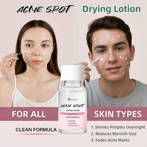 **Skiennix Premium Drying Lotion - Overnight Solution for Pimples & Blemishes, 12ml**