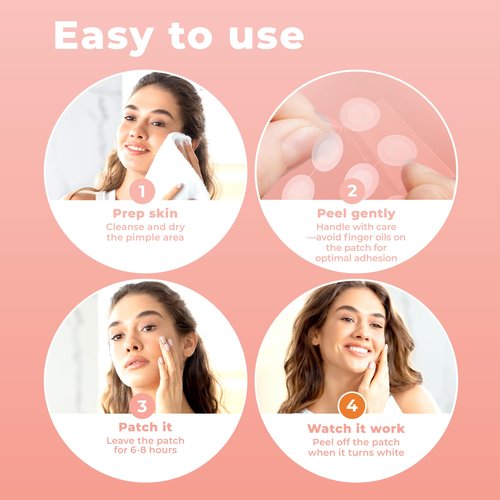 PatchRx Micro Needle Pimple Patch (18 Pack) - Hydrocolloid Micropoint Pimple Patch For Acne & Pimples, Microdart Patch, Micro Dart Pimple Patches