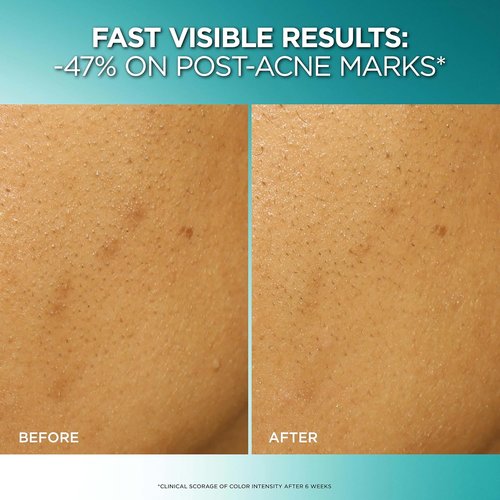 L'Oreal Paris Bright Reveal Exfoliant Peel - 25% AHA BHA PHA Face Exfoliator for Dark Spots & Renewed Texture