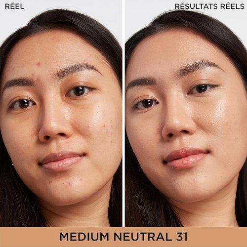 IT Cosmetics Bye Bye Dark Spots Concealer & Brightening Serum - 2% Niacinamide, Hyaluronic Acid, Caffeine - Medium Coverage, Natural Finish - 0.22 fl oz