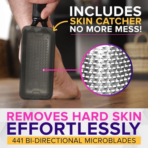 NYK1 Megafile Foot Callus Remover - Rustproof XL Size with Skin Catcher for Wet & Dry Use