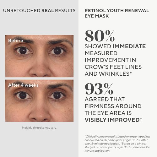 Murad Retinol Youth Renewal Eye Masks - No-Slip Bio-Cellulose Under Eye Patches for Lines & Puffiness