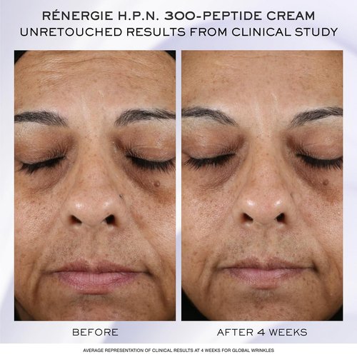 Lancôme Rénergie Skincare Trial Gift Set - Anti-Aging Essentials with Genifique, Day/Night Cream & Eye Cream (1.6 Fl Oz)