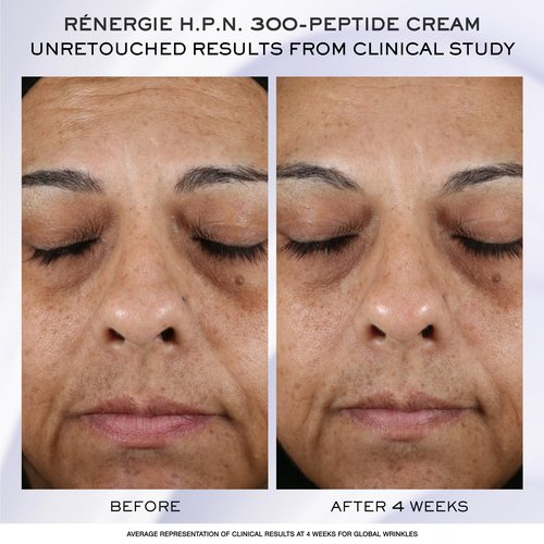 Lancôme Rénergie Skincare Trial Gift Set -Trial Set for Anti-aging Skincare Routine With Genifique Ultimate, Rénergie Day/Night Cream, and Eye Cream (1.6 Fl Oz)
