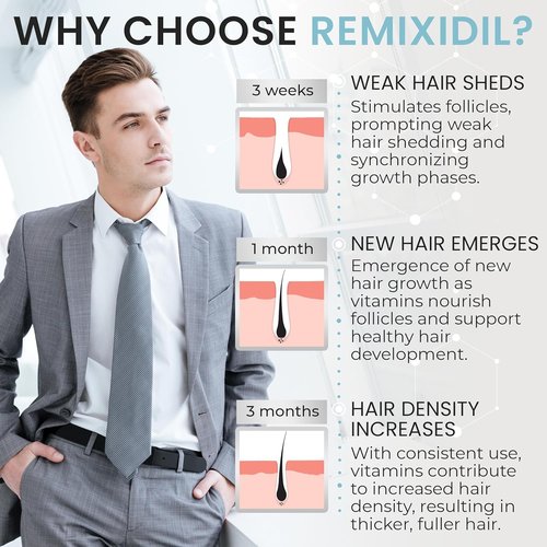 Hair Growth Vitamins - Regrow Hair & Beard | Strengthen Scalp & Reduce Thinning | Fast-Acting 60 Capsules