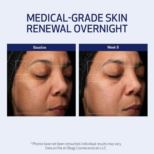 Obagi Medical Retinol + PHA Night Cream - Clinically Proven Anti-Aging Formula for Smoother Skin - 1.7 Oz