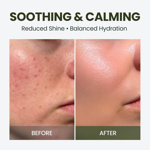 HyCicaMue Defence Cream - Soothing Barrier Repair Moisturizer with Cica & Hyaluronic Acid | Vegan Formula for Sensitive Skin, Sebum Control & Hydration | Korean Skincare