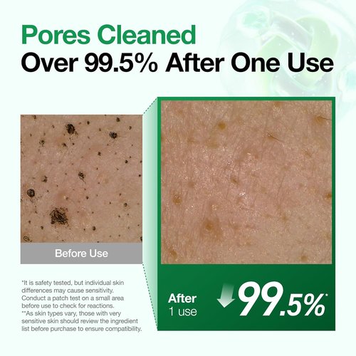 Anua Heartleaf Quercetinol Pore Deep Cleansing Foam - Hydrating Daily Facial Cleanser, 5.07 fl. oz.
