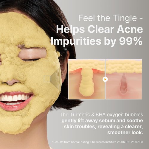 P.CALM Turmeric Bubble Deep Mask - Dark Spot Corrector with AHA/BHA & Carbonated Water | Korean Skincare, 90g