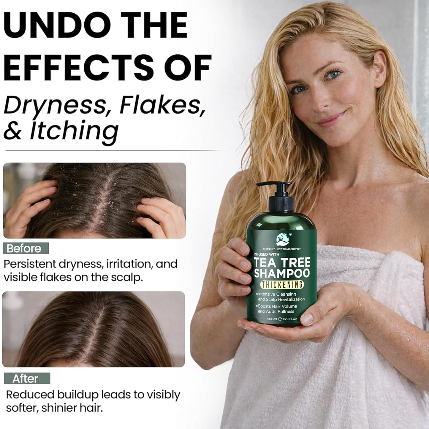 Tea Tree Shampoo & Conditioner Set - Thinning Hair Treatment for Men & Women | Soothes Itchy Scalp & Dandruff