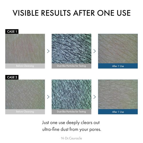 Dr.Ceuracle Pro Balance Enzyme Powder Face Wash - Natural Deep Cleansing & pH Balancing for Day/Night Use