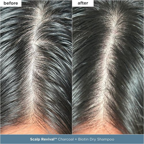 Briogeo Scalp Revival Scalp Care Essentials Set - Detox & Hydrate with Charcoal & Tea Tree | Vegan & Cruelty-Free
