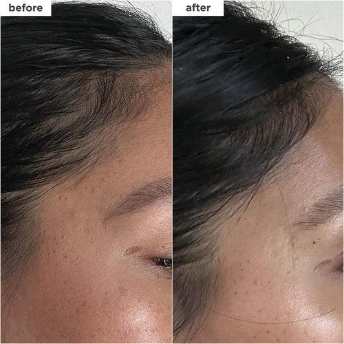 Briogeo Destined For Density Serum - Caffeine & Biotin Peptide for Thicker, Voluminous Hair | Fast-Absorbing, Non-Greasy, Vegan