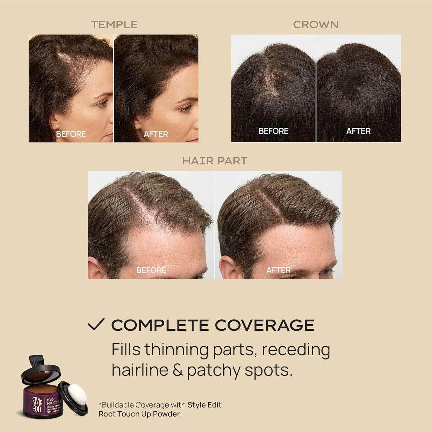 Style Edit Hair Building Fibers - Conceal Thinning Hair & Receding Hairlines | 100% Plant-Based, Dark Brown, 0.88oz