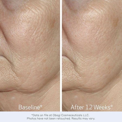 Obagi ELASTIderm Facial Serum - Firming Serum with Bi-Mineral Complex for Youthful Skin