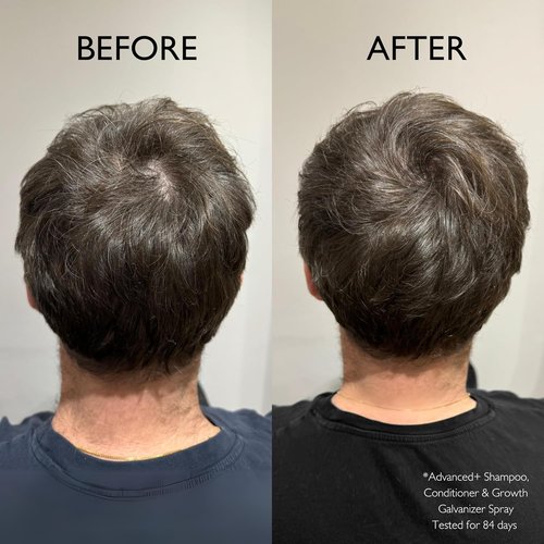 Daimon Barber Hair Growth Galvanizer for Men - Advanced Formula, 3.38 oz Spray