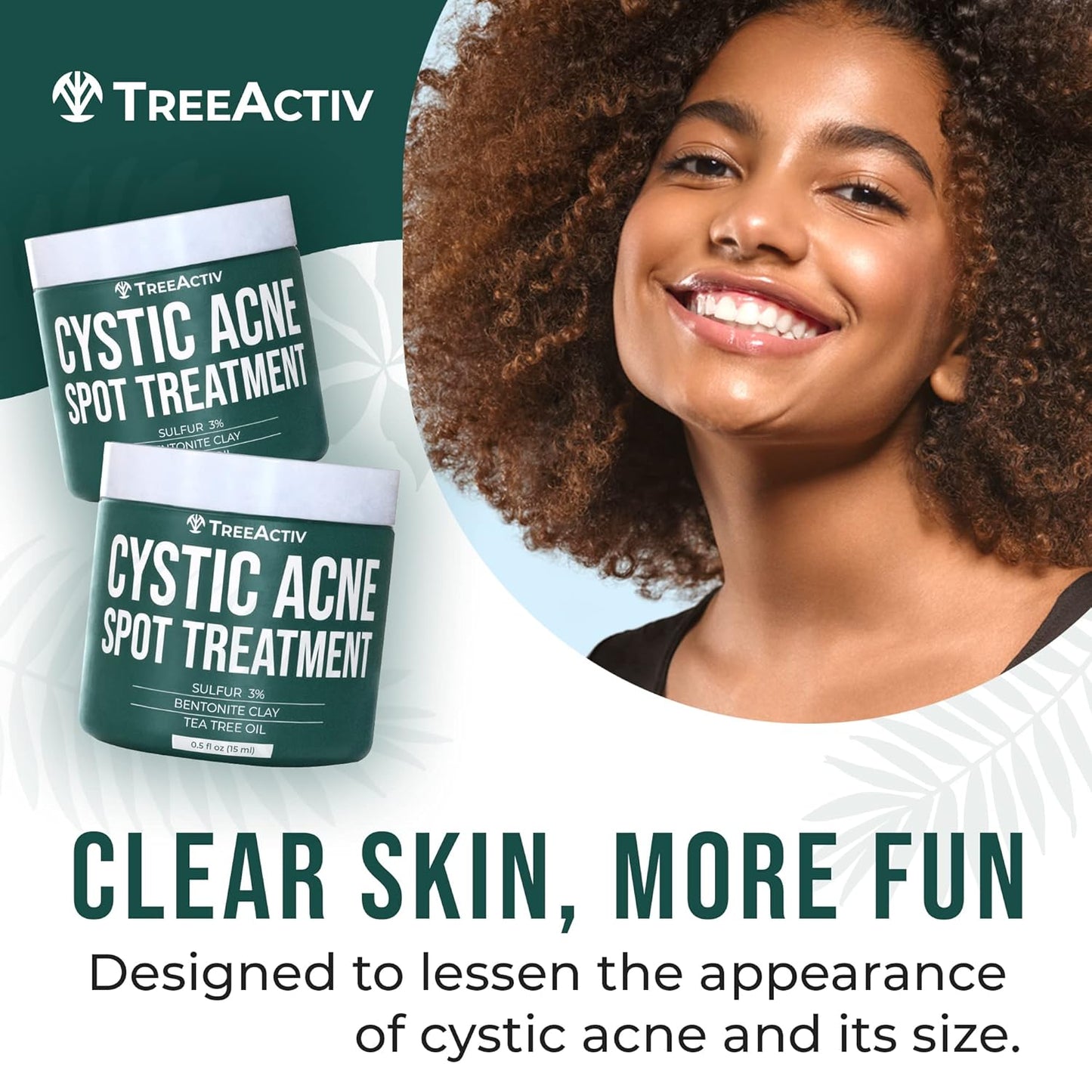 TreeActiv Cystic Acne Spot Treatment Paste - Sulfur & Tea Tree Oil for Deep Breakouts | 0.5 oz