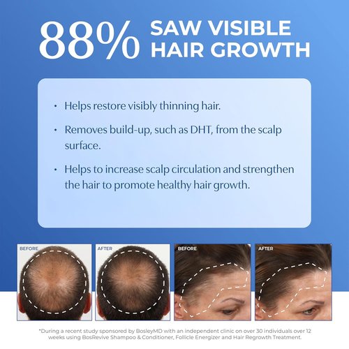 BosRevive Nourishing Shampoo - Restores Thinning Hair & Boosts Scalp Circulation | Sulfate-Free 33.8 Fl Oz