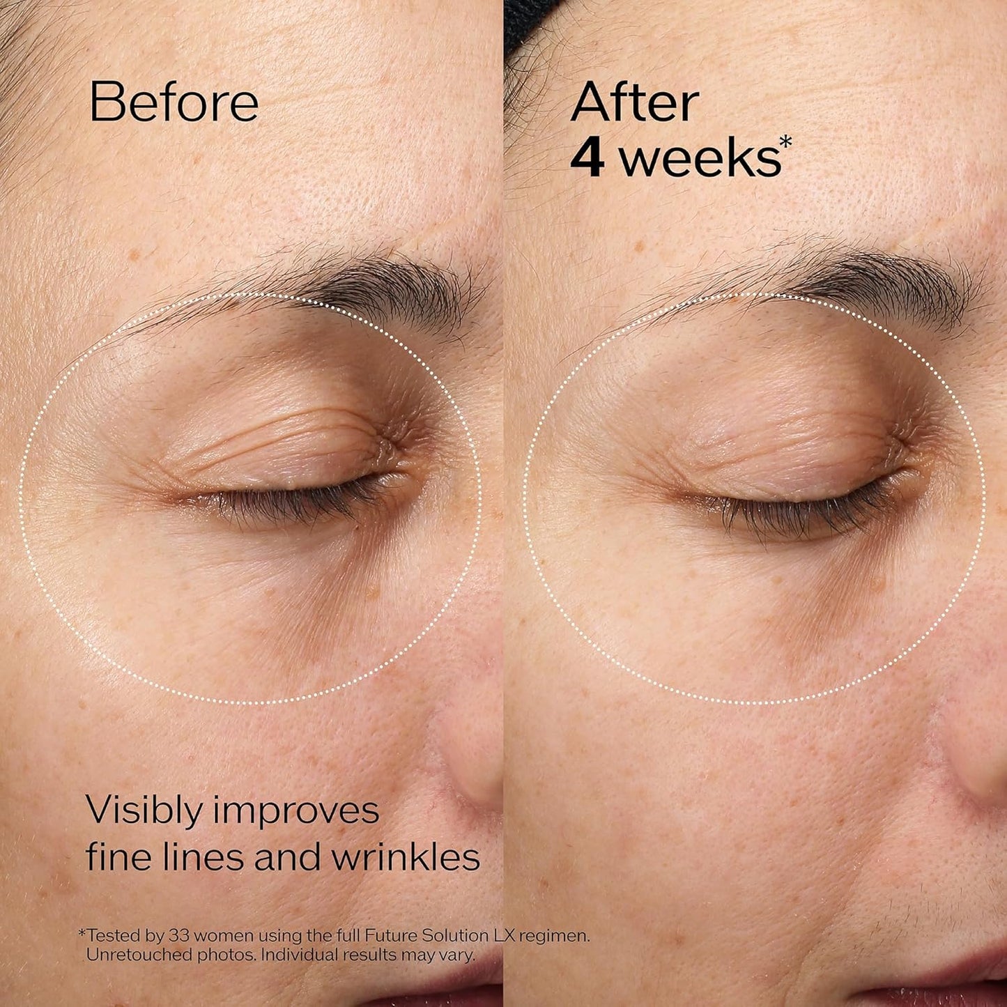 Shiseido Future Solution LX Eye & Lip Contour Regenerating Cream - 17 mL | Reduces Wrinkles & Sagging for All Skin Types