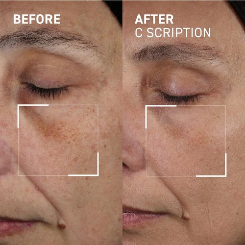 Dr. Brandt Bright This Way C Scription - Vitamin C Serum for Dark Spots & Wrinkles - 1 Fl Oz