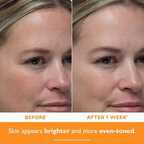 Peter Thomas Roth | Potent-C™ Power Serum - Brightening & Anti-Aging Formula for Radiant Skin