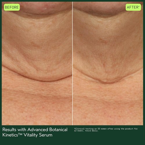 Aveda Advanced Botanical Kinetics Vitality Serum - Reduces Fine Lines & Wrinkles | Vegan | 1 Fl Oz