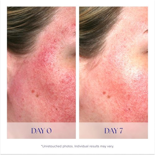iS CLINICAL Pro-Heal Serum Advance+ | Antioxidant-Rich Vitamin C Serum for Calming Sensitivity & Redness