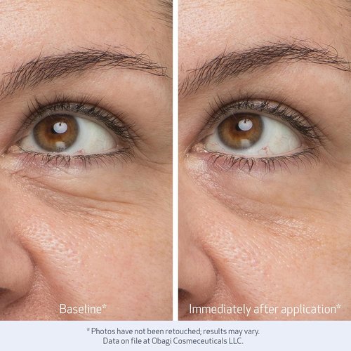 Obagi Daily Hydro-Drops Eye Gel Cream - Instantly Brightens & Smooths Dark Circles - 0.5 oz