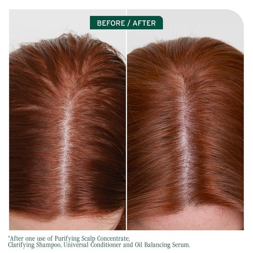 Biolage Scalp Sync Clarifying Shampoo & Conditioner Set - Removes Buildup & Oil, Vegan, 33.8 Fl Oz