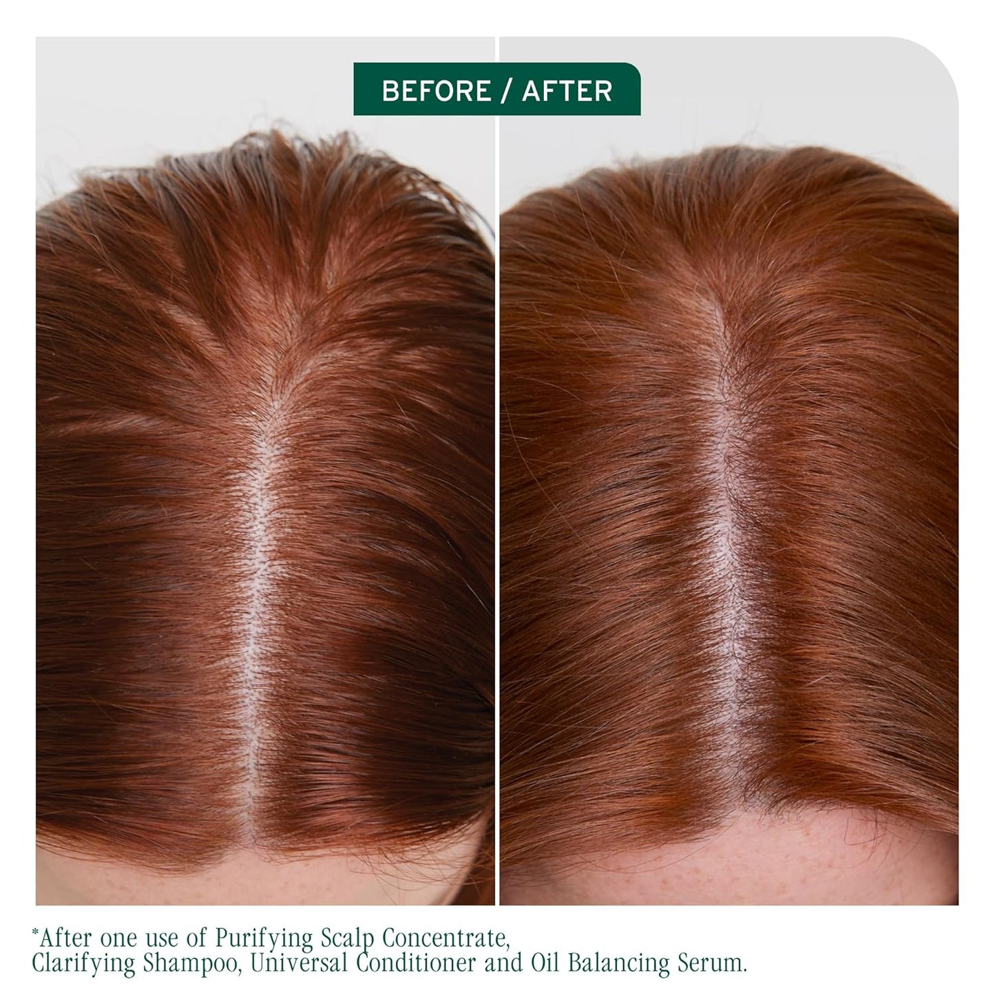 Biolage Scalp Sync Clarifying Shampoo & Universal Conditioner Set - Oily Scalp Residue Remover, Vegan & Paraben-Free