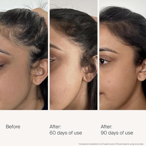 Living Proof Scalp Care Density Serum - Boost Hair Thickness & Nourish Scalp | 2 oz