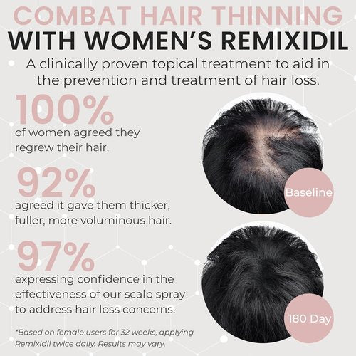 Minoxidil 2% Hair Regrowth Spray for Women | Thicker, Fuller Hair - Clinically Proven Formula - 60 ml