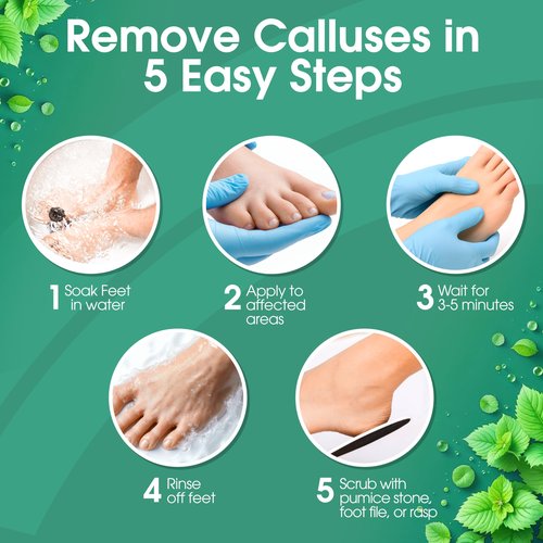 DeEnti Callus Remover for Feet, Extra Strength Foot Callus Remover Gel, 16oz Salon Grade Home Pedicure Supplies for Dry Skin, Cracked Heel, Professional Strength Foot Care, Cool Mint