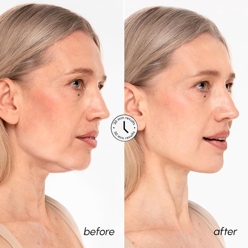 MAREE V Line Lifting Mask - 24K Gold Collagen Face Mask for Women | Neck Tightening & Firming