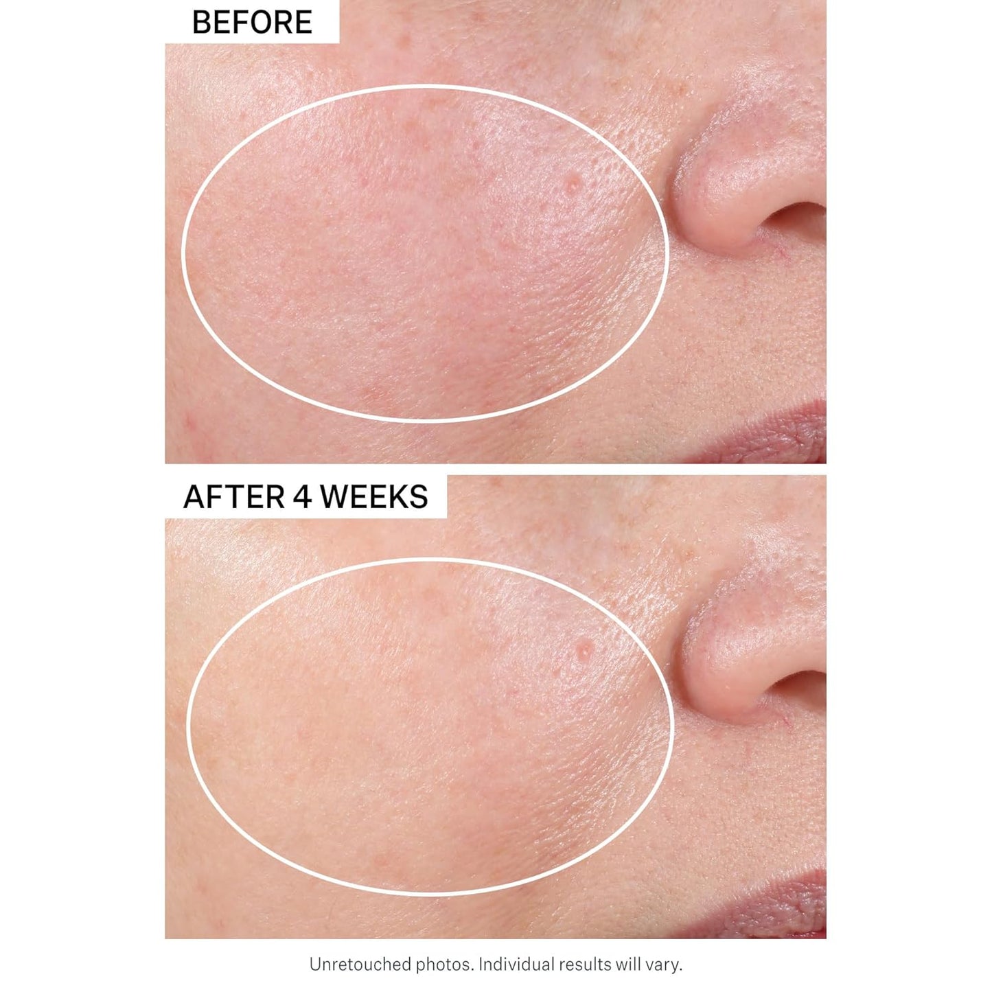StriVectin Advanced Retinol Discovery Kit - Night Moisturizer & Eye Cream for Wrinkles | 2-Piece Set