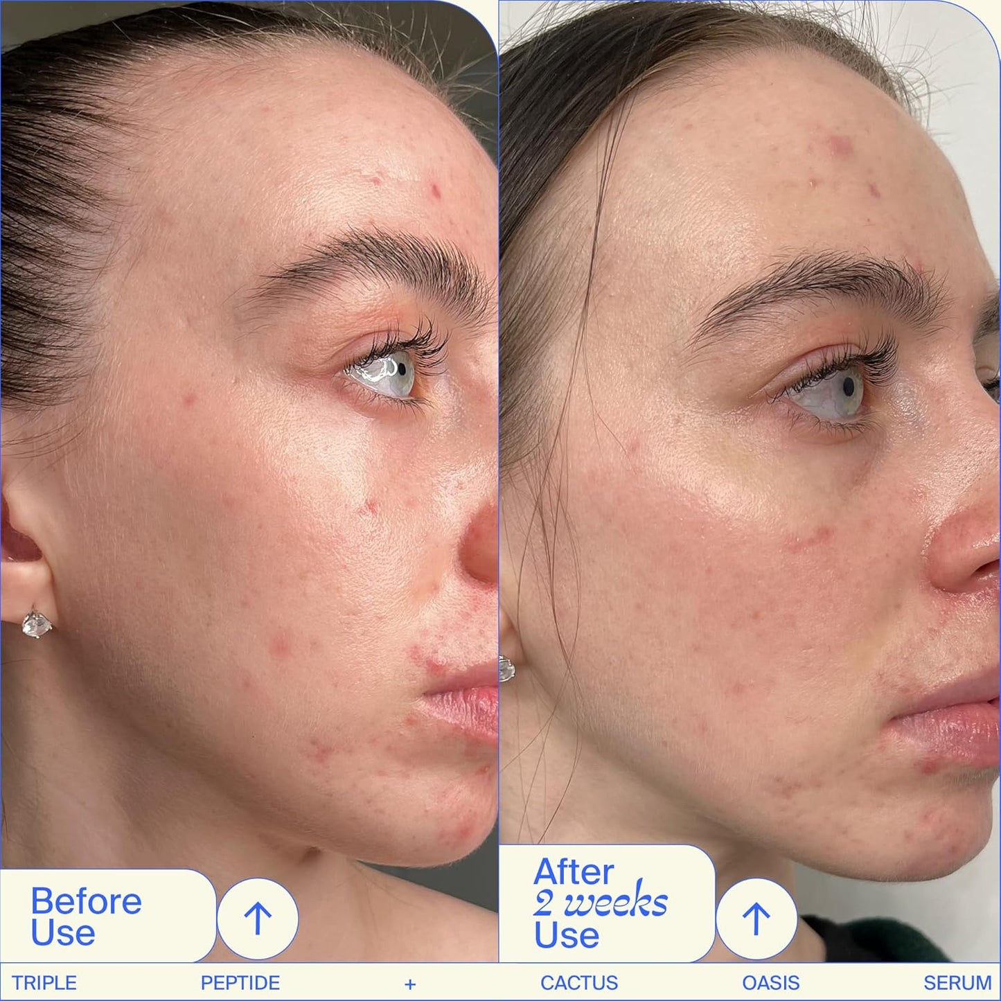 Youth To The People Triple Peptide + Oasis Face Serum - Hydrating + Firming Serum for Dry Skin, Plumps Fine Lines with 4 Types of Hyaluronic Acid, Peptides, Preps for Makeup, Fragrance-free - 1 fl oz