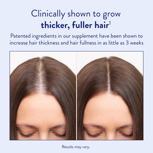 Routine Wellness Hair Growth Supplement – CLINICALLY Tested Thicker, Fuller-Looking Hair Support with Biotin & Key Nutrients, Vegetarian & Gluten-Free Vitamins - 1 Bottle, 30 Day Supply
