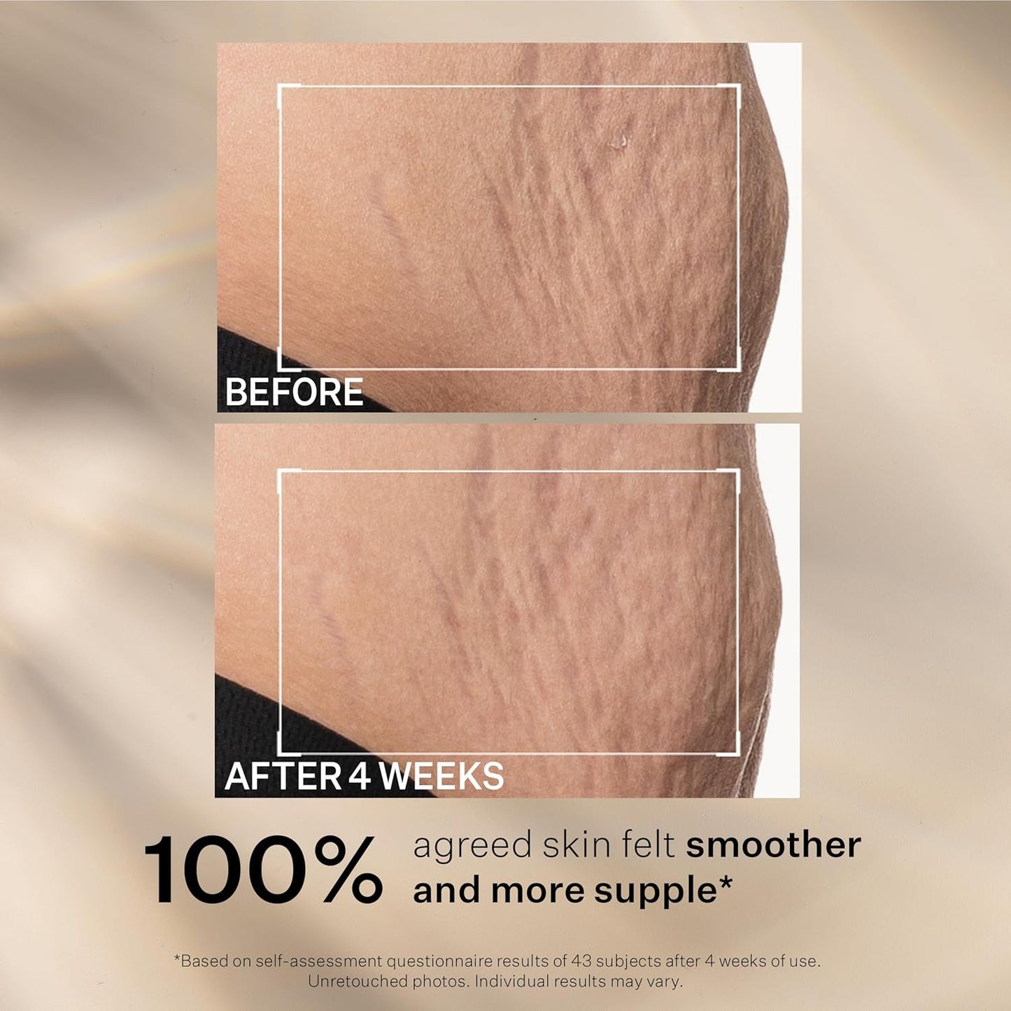 StriVectin SD Advanced Plus Intensive Moisturizer - Collagen Boosting for Wrinkles & Stretch Marks | Face & Body
