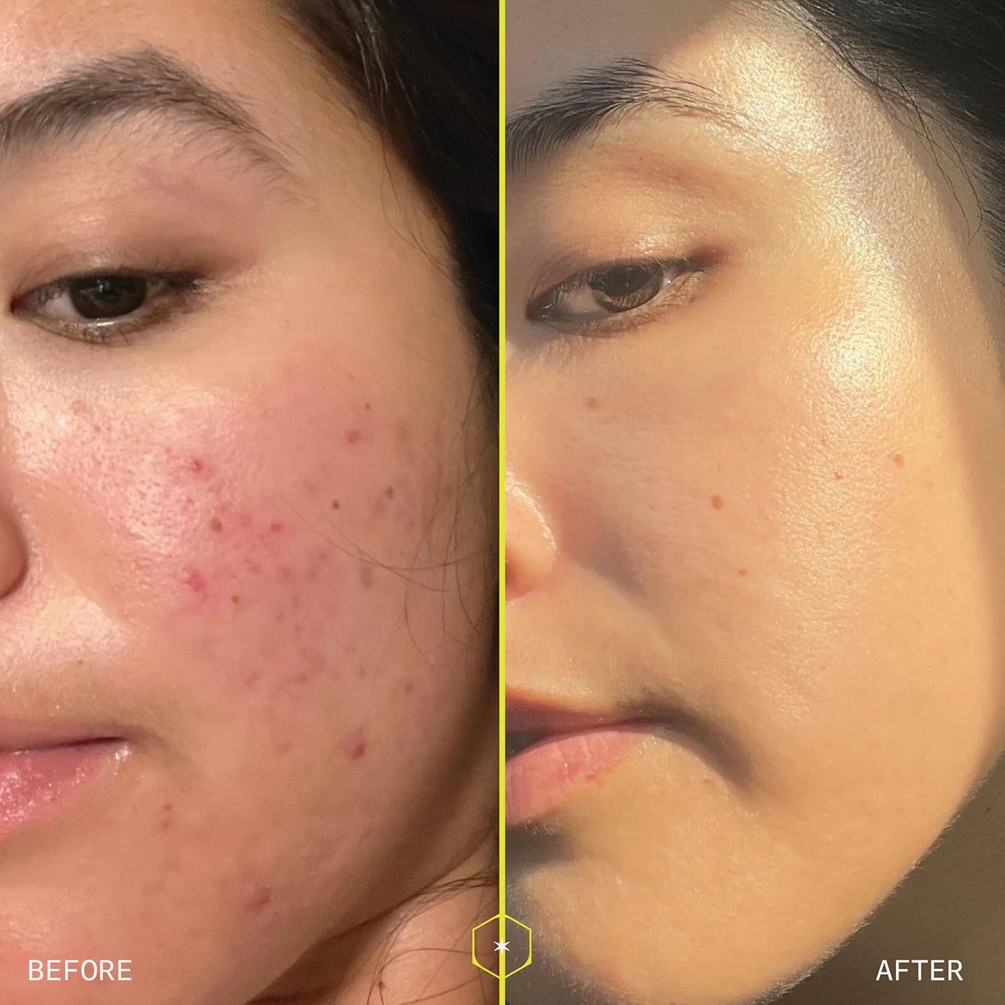 Skiennix 1% Retinol Peptide Boosting Serum - Reduces Wrinkles & Discoloration - 30ml with Collagen Peptides