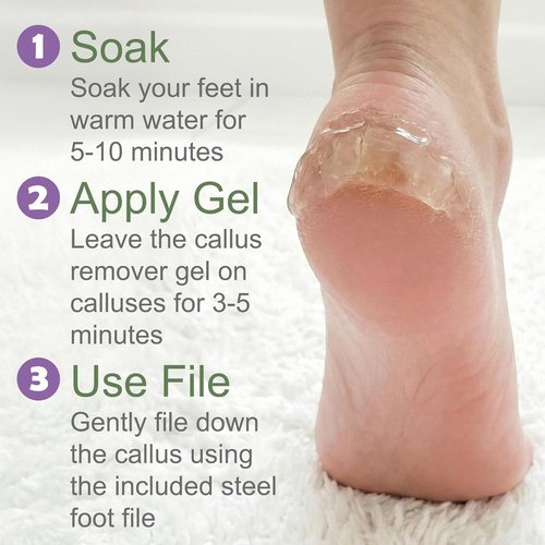 Dr. Entre's Callus Remover Gel - Extra Strength Foot Care & Pedicure Tools | 4 oz Spa Kit