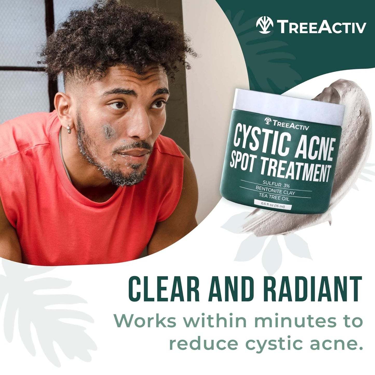 TreeActiv Cystic Acne Spot Treatment Paste - Sulfur & Tea Tree Oil for Deep Breakouts | 0.5 oz