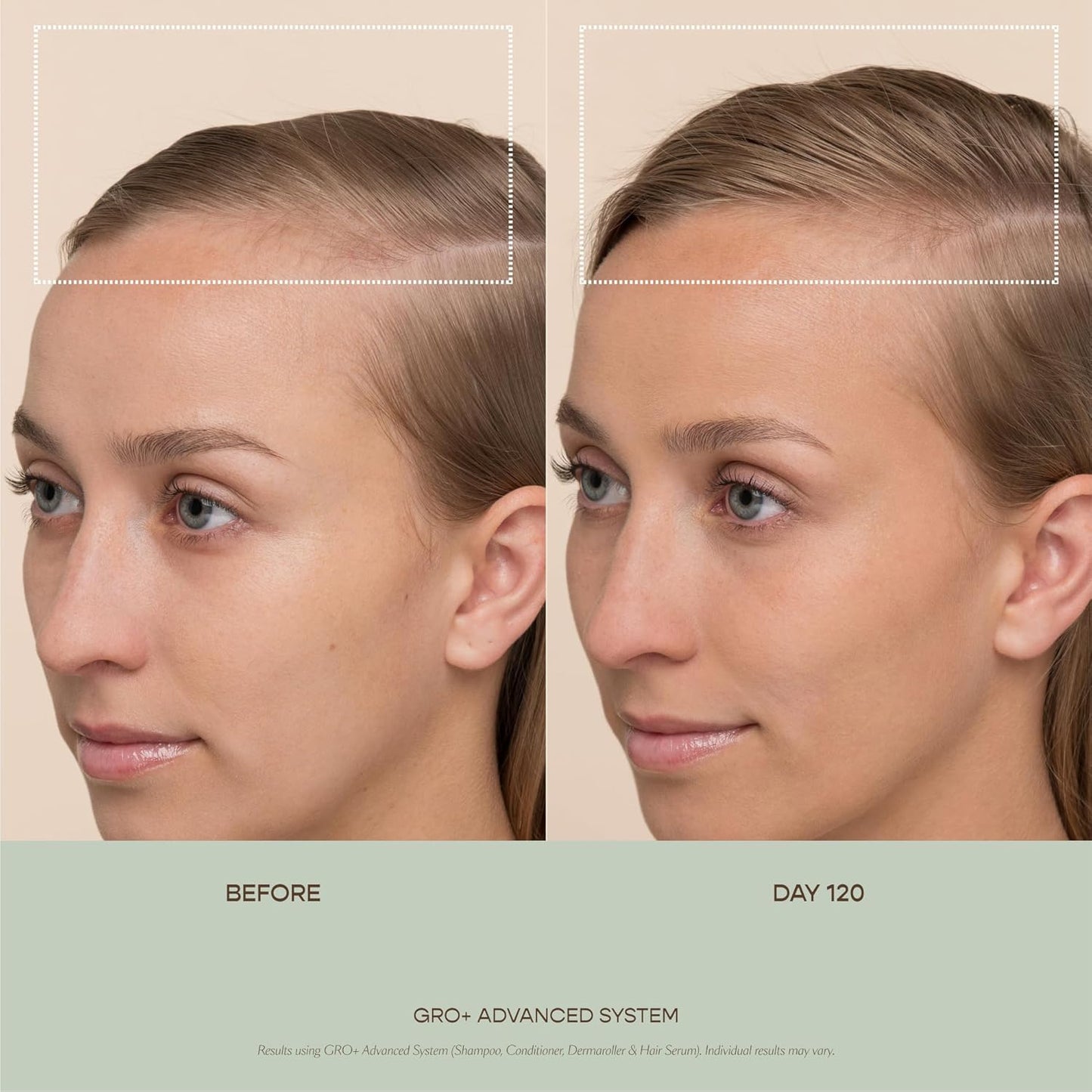 VEGAMOUR GRO+ Advanced Hair Serum - Boosts Hair Density & Reduces Shedding | Fragrance-Free, Vegan, Cruelty-Free