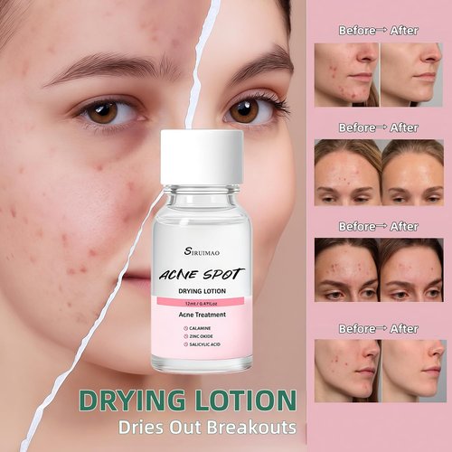 **Skiennix Premium Drying Lotion - Overnight Solution for Pimples & Blemishes, 12ml**